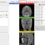 3D Slicer Advanced Features: Boost Precision | DentIIT