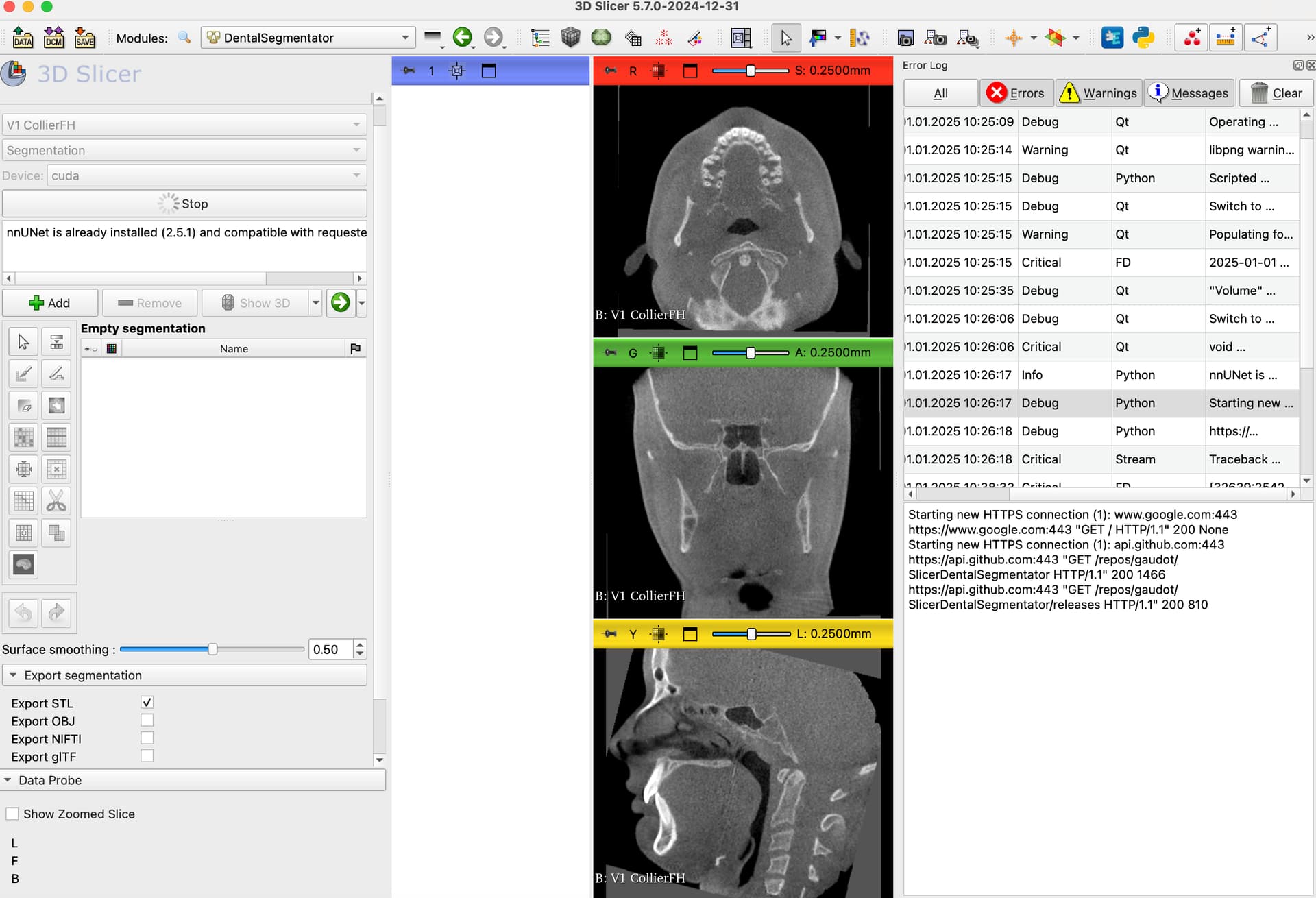 3D Slicer Advanced Features: Boost Precision | DentIIT