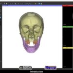3D Slicer STL Export: Print Dental Models | DentIIT