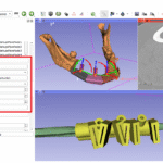 3D Slicer Guide for Beginners: Start Fast | DentIIT
