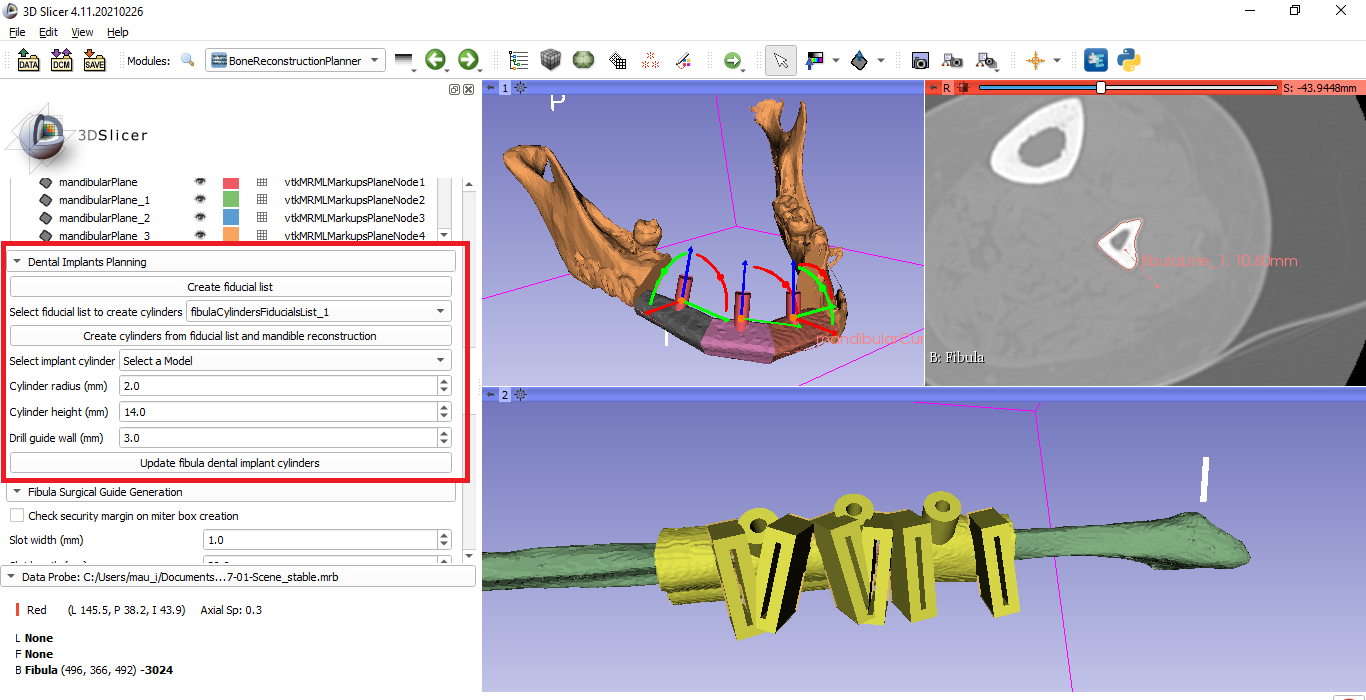 3D Slicer Guide for Beginners: Start Fast | DentIIT