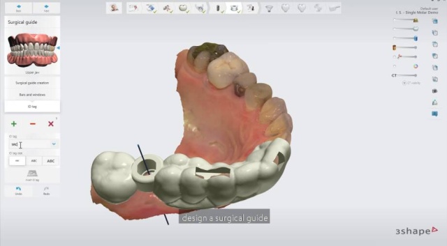 3D Slicer Printing: From Scan to Model | DentIIT