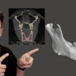 3D Slicer Interface: Easy Navigation Tips | DentIIT