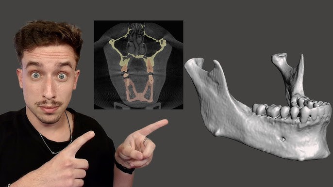 3D Slicer Interface: Easy Navigation Tips | DentIIT