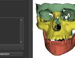 3D Slicer Alternatives: Top Dental Apps | DentIIT