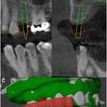 3D Slicer Pricing: Free Yet Powerful | DentIIT
