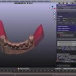 3D Slicer Rendering: Sharper Dental Views | DentIIT