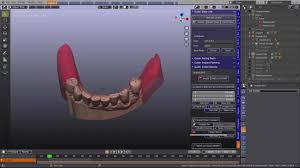 3D Slicer Rendering: Sharper Dental Views | DentIIT
