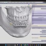 3D Slicer Shortcuts: Work Faster in Clinic | DentIIT