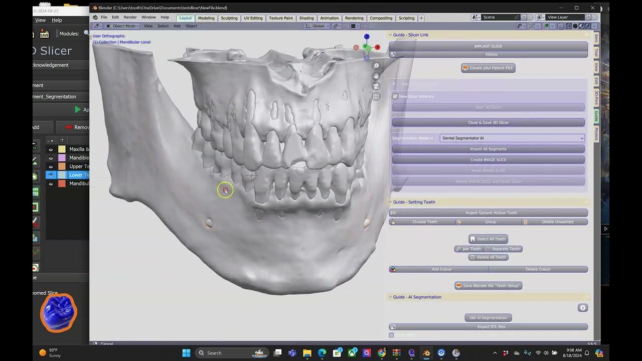 3D Slicer Shortcuts: Work Faster in Clinic | DentIIT