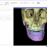 3D Slicer Requirements: Optimize Your System | DentIIT