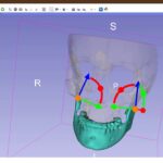 3D Slicer DICOM: Load CBCT Like a Pro | DentIIT