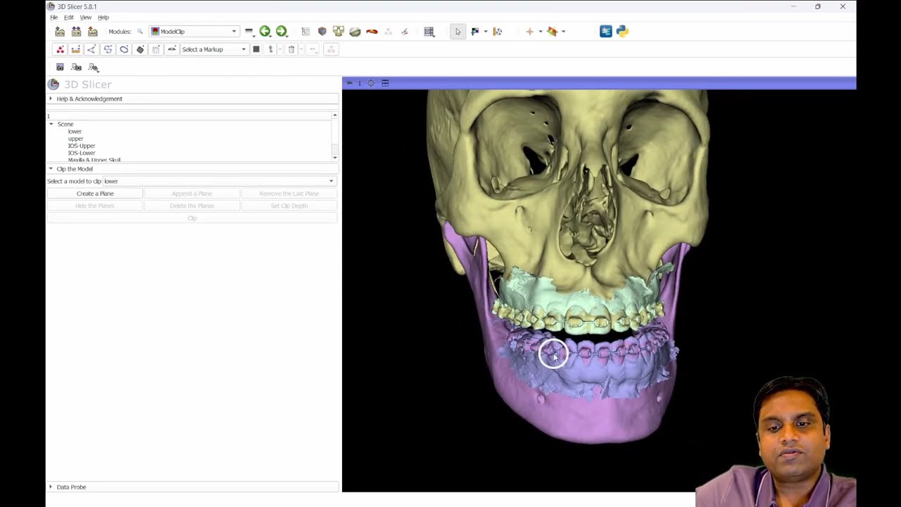 3D Slicer Requirements: Optimize Your System | DentIIT