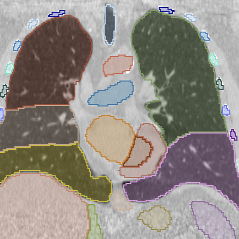 VolView, what is VolView used for, patient chart migration with dedupe archives and recovery