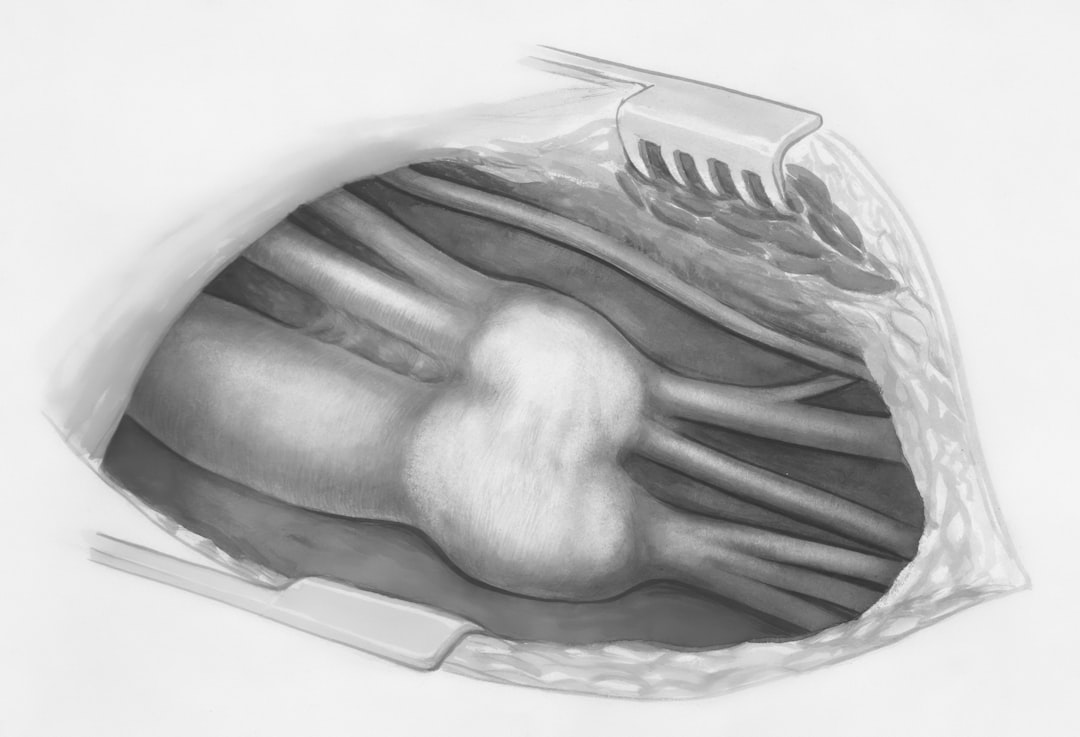 VolView, how to install VolView, 3D planning tutorial with rollback-friendly data storage