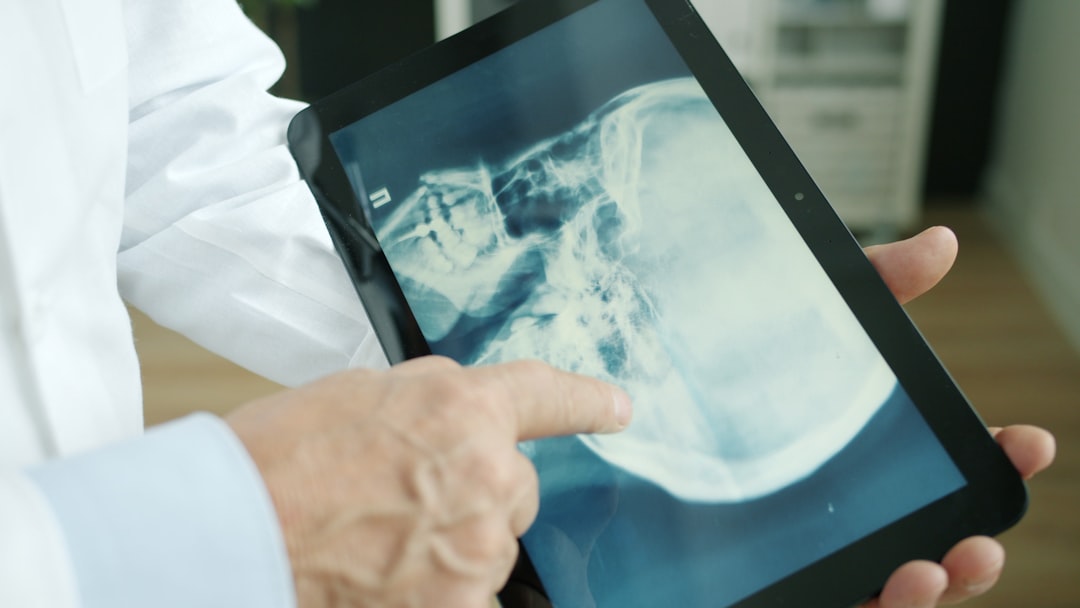 Ginkgo CADx, how to export DICOM from Ginkgo CADx, image import guide with restore points for safe edits