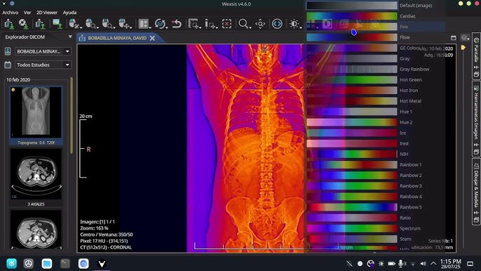 Weasis DICOM Viewer, how to back up Weasis DICOM Viewer data, free dental tool setup with encrypted backup routines