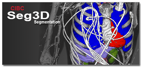 Seg3D, how to install Seg3D, 3D planning tutorial with rollback-friendly data storage