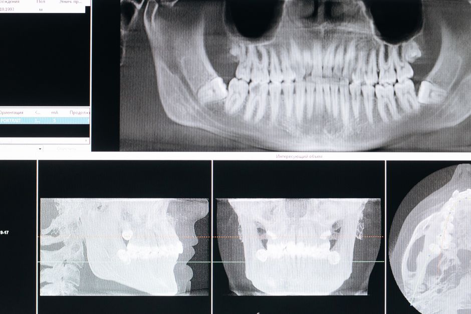 dental imaging news, dental imaging news 2026, dental imaging news tools